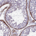 Immunohistochemical staining of human testis shows moderate membranous positivity.