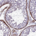 Immunohistochemical staining of human testis shows moderate membranous positivity.