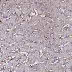 Immunohistochemical staining of human liver shows moderate membranous positivity in hepatocytes.