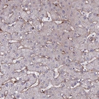 Immunohistochemical staining of human liver shows moderate membranous positivity in hepatocytes.
