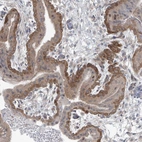 Immunohistochemical staining of human placenta shows moderate cytoplasmic positivity in trophoblastic cells.
