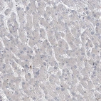 Immunohistochemical staining of human liver shows no cytoplasmic positivity in hepatocytes as expected.