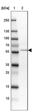 Lane 1: Marker [kDa] 250, 130, 100, 70, 55, 35, 25, 15, 10_br/_Lane 2: Human cell line MOLT-4