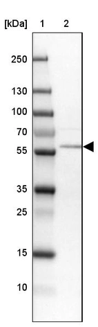 Lane 1: Marker [kDa] 250, 130, 100, 70, 55, 35, 25, 15, 10_br/_Lane 2: Human cell line MOLT-4