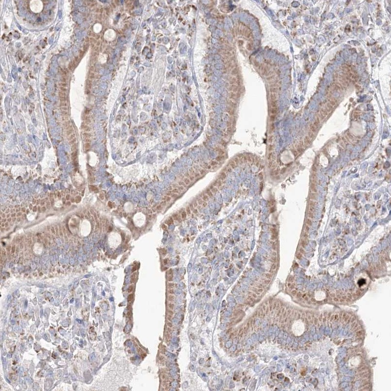 Anti-KCTD6 Antibody