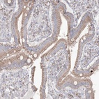 Anti-KCTD6 Antibody