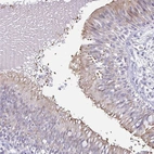Anti-FAM162B Antibody