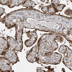 Immunohistochemical staining of human placenta shows moderate nuclear positivity in trophoblastic cells.