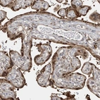 Immunohistochemical staining of human placenta shows moderate nuclear positivity in trophoblastic cells.