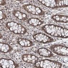 Immunohistochemical staining of human rectum shows moderate nuclear positivity in glandular cells.