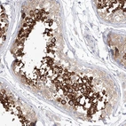 Immunohistochemical staining of human testis shows high expression.