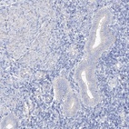 Anti-SHCBP1L Antibody