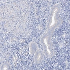 Immunohistochemical staining of human endometrium shows low expression as expected.