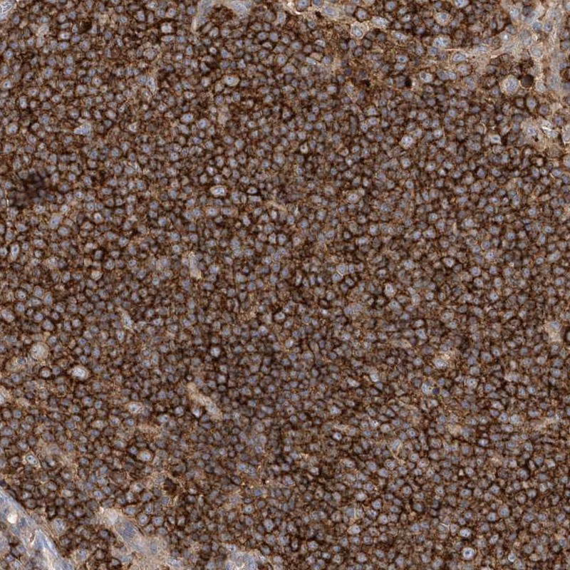 Anti-IL1RAPL2 Antibody