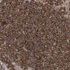 Anti-IL1RAPL2 Antibody