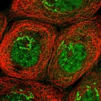 Immunofluorescent staining of human cell line A-431 shows localization to nucleoplasm & the Golgi apparatus.