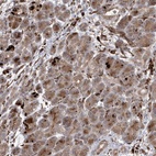 Anti-IL1RAPL2 Antibody