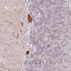 Anti-AMTN Antibody