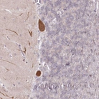 Anti-AMTN Antibody