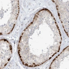 Immunohistochemical staining of human testis shows moderate to strong cytoplasmic positivity in spermatogonia.