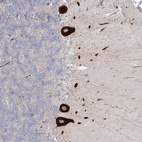 Anti-FAM110C Antibody