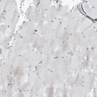 Immunohistochemical staining of human skeletal muscle shows no positivity in myocytes as expected.