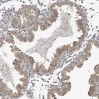 Immunohistochemical staining of human endometrium shows moderate cytoplasmic positivity in glandular cells.