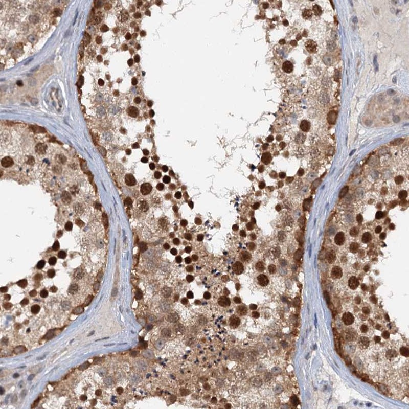 Anti-TAS2R42 Antibody