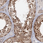 Anti-TAS2R42 Antibody