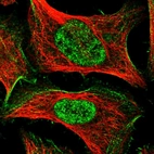 Immunofluorescent staining of human cell line U-2 OS shows localization to nucleoplasm, actin filaments & focal adhesion sites.
