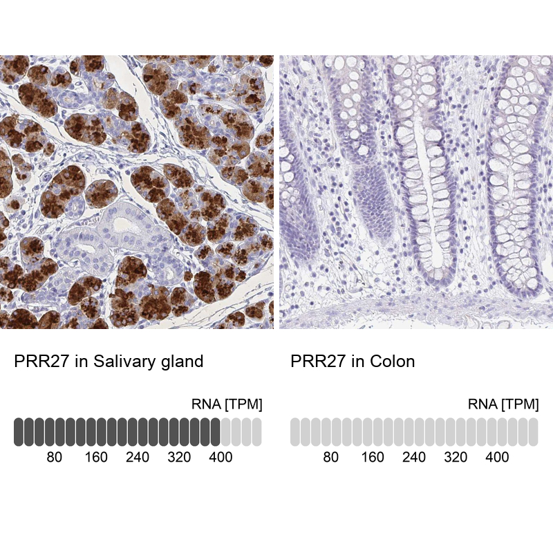 Anti-PRR27 Antibody
