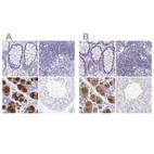 Immunohistochemical staining of human colon, lymph node, salivary gland and testis using Anti-PRR27 antibody HPA036151 (A) shows similar protein distribution across tissues to independent antibody HPA036150 (B).