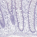 Immunohistochemical staining of human colon shows low expression as expected.