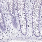 Immunohistochemical staining of human colon shows low expression as expected.