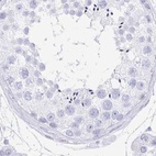 Immunohistochemical staining of human testis using Anti-PRR27 antibody HPA036151.