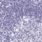 Immunohistochemical staining of human lymph node using Anti-PRR27 antibody HPA036151.