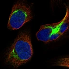 Immunofluorescent staining of human cell line U-2 OS shows localization to intermediate filaments.