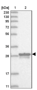 Lane 1: Marker [kDa] 230, 130, 95, 72, 56, 36, 28, 17, 11_br/_Lane 2: Human cell line RT-4