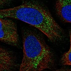 Immunofluorescent staining of human cell line U-2 OS shows localization to vesicles.