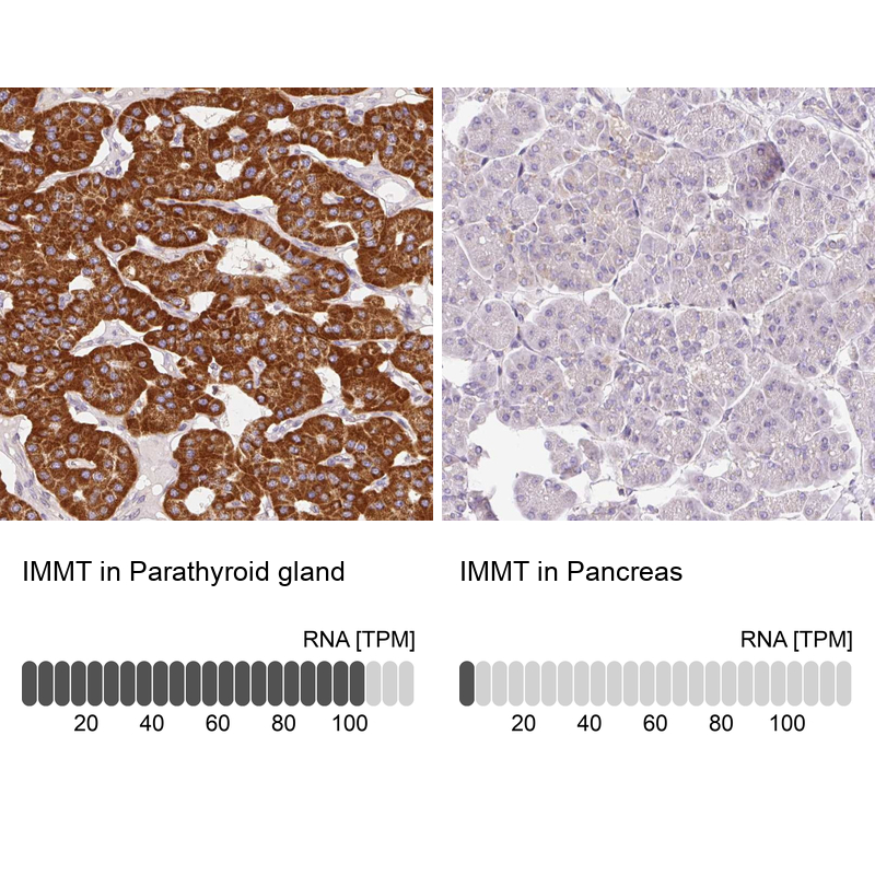 Anti-IMMT Antibody