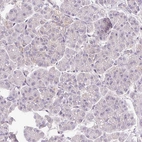 Immunohistochemical staining of human pancreas shows low expression as expected.