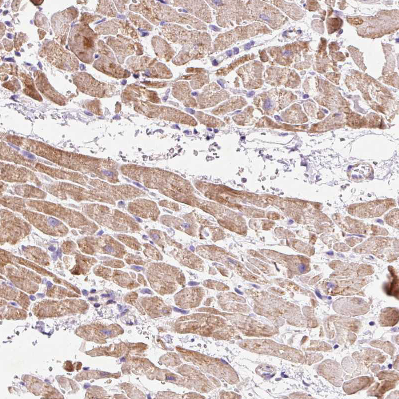 Anti-IMMT Antibody