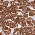 Immunohistochemical staining of human parathyroid gland shows high expression.