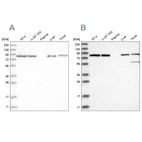 Western blot analysis using Anti-IMMT antibody HPA036164 (A) shows similar pattern to independent antibody HPA036165 (B).