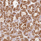 Immunohistochemical staining of human stomach shows strong granular cytoplasmic positivity in glandular cells.