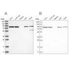 Western blot analysis using Anti-IMMT antibody HPA036165 (A) shows similar pattern to independent antibody HPA036164 (B).