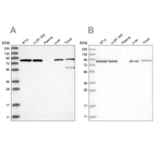 Western blot analysis using Anti-IMMT antibody HPA036165 (A) shows similar pattern to independent antibody HPA036164 (B).