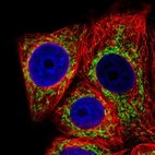 Immunofluorescent staining of human cell line MCF7 shows localization to mitochondria.