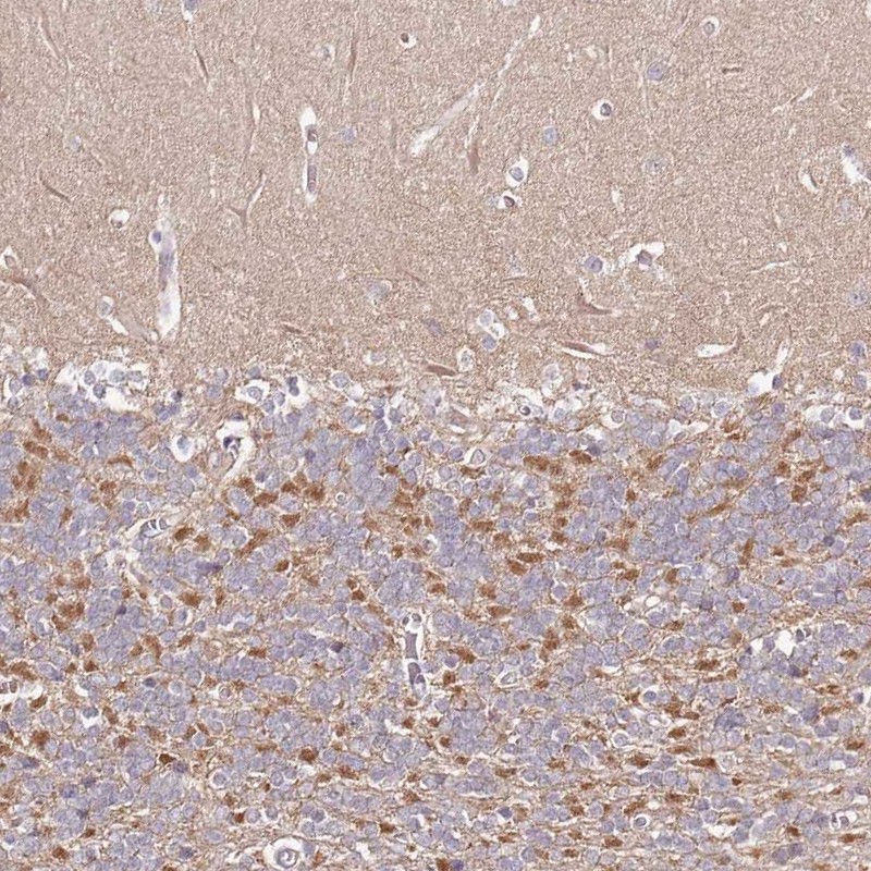 Anti-FAM126B Antibody