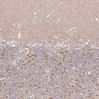 Anti-FAM126B Antibody